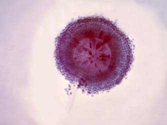 aspergillus_niger_con