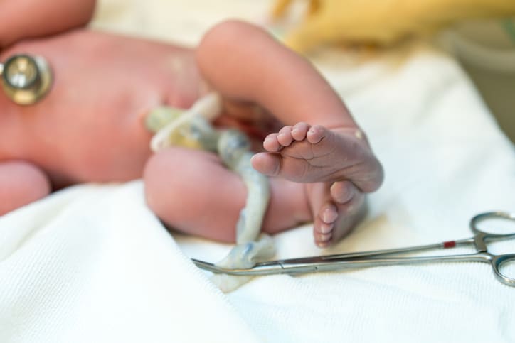 Umbilical Cord Conditions: How Your Doctor’s Negligence Could Lead to Serious Birth Injuries