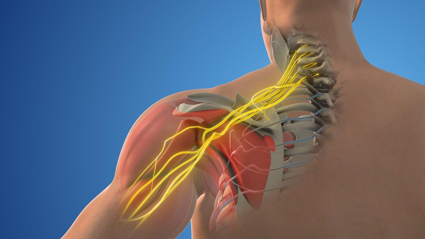 Attachment Details

Brachial Plexus Injury Lawyers Indiana
