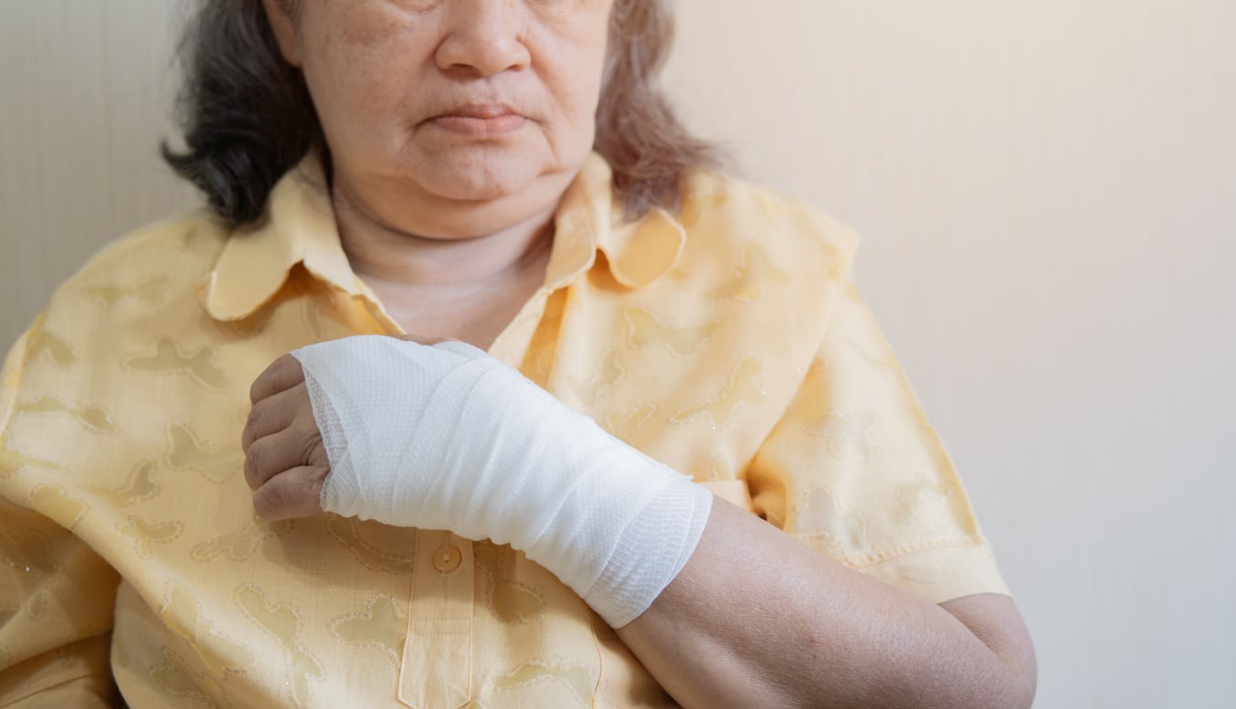 burn injuries attorney Indianapolis