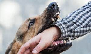 Why Choose Wilson Kehoe Winingham Injury Lawyers to Help After a Dog Bite Injury in Indianapolis?